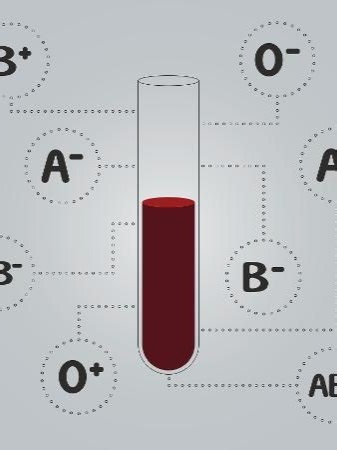 Learn all about ABO blood groups in this animated video! Discover A, B, AB, and O blood types, their antigens, and why blood compatibility matters. #bloodgroup #ABObloodgroup #educational #medicalanimation #VoiceExplained #VoiceScience #MedicalEducation #LearnWithAnimation #ScienceExplained #visual_learners #voiceover #foryoupage #HealthEducation