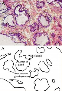 Stroma (tissue) - Alchetron, The Free Social Encyclopedia