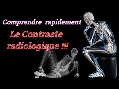 Comprendre le Contraste Radiologique : Fondements Physiques et Applications Diagnostiques