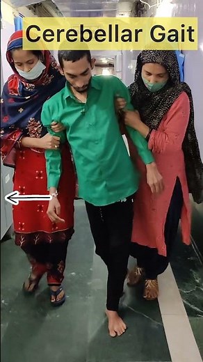 Cerebellar Gait #cerebellum #cns #ataxia #shorts