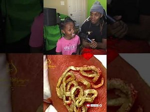 Best Pimple Popping // Blackhead Removal | Tiktok Reaction | Satifying Video *NEW 2022* Part 5