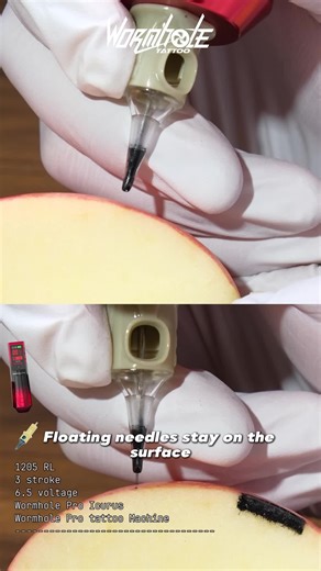 Understanding Suspended vs. Embedded Needling Techniques