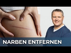 Effektive Methoden zur Narbenentfernung: Was wirklich hilft!