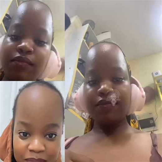 She got a real life megamind head😭