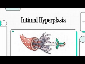 005 Intimal Hyperplasia