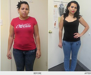 Go for Extreme Makeover and Surprise the World!