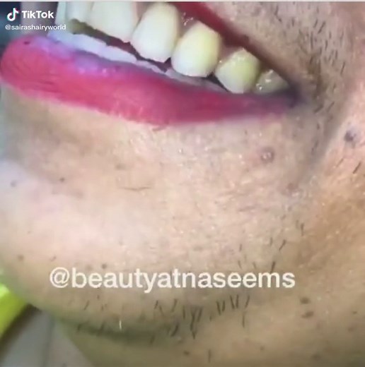 Oh dear￼ try not to shave your face. #shaved #facialhair #skinproblems #hairygirl #viral #tiktoker #beautytips