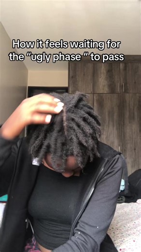 Understanding the Ugly Phase of Locs Journey