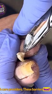 Senior health focus on gentle nail support #SeniorHealth #EverydayCare #FootSupport | NC State Wolfpack on TheWolfpacker.com