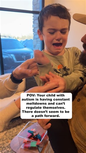 When a child comes in with autism and constant meltdowns, we start by looking at the most foundational parts of their nervous system. In the first year of life, primitive reflexes help fire the brain into higher centers. Every early movement sends signals into the cortex again and again. As the frontal lobe matures, it should eventually take control and shut these reflexes down. When those reflexes are still active, it tells us that this pathway did not fully develop. The frontal lobe is not reg