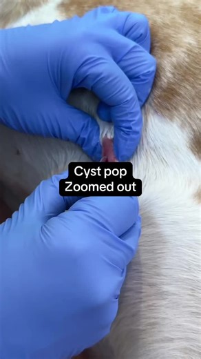 #pop #pimple #cyst #satisfying