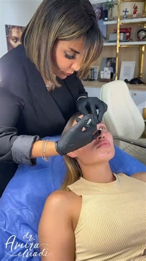 11 reactions | Botox for full face contouring by #dr_amira_elnadi...