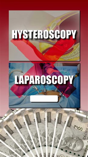 Female Infertility Solved In Half The Cost | Fallopian Tube Recanalization #shorts