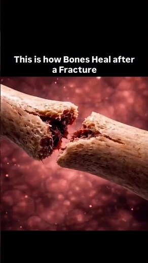 The Healing Process of a Broken Bone is INSANE! 🦴🔥 #science