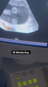 45K views · 518 reactions | 30 Weeks baby boy ultrasound Scan | Dr.aneela manzoor-RPH | Facebook
