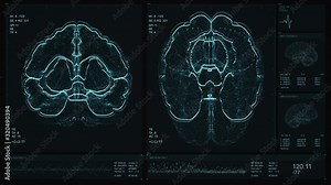 Brain scan screen animation. Device scanning process. Vital signs on display. Neurology data analysis. Diagnosis of disease. Futuristic video. 4K Medical Hud Healthcare footage. Hospital Equipment