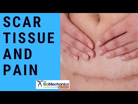 Scar Tissue and Pain