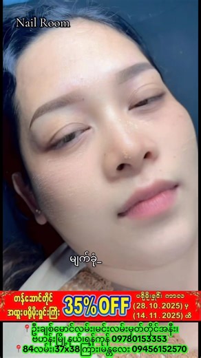 🎊Promotion ကြီး ပြီးဖို့ (4) ရက်သာ လိုပါတော့တယ်ရှင့်🥰 🏡Nail Room ရဲ့ တန်ဆောင်တိုင် ၃၅% Discount အထူး Promotion ကြီးစပါပြီနော် 🤭🥳🥳 💁‍♀️Member Card ရှိတဲ့ကာကာများ 35% Discount 💁‍♀️Member မရှိတဲ့ ကာကာများကတော့ 30%Discount ကြီးရရှိမှာပါနော် 🥰😱😱🤭 Promotion ကာလ - 28.10.2025 မှ 14.11.2025အထိသာ ✅️ 🏠Nail Room မှာ Gel Colour များကို ၁၅၀၀၀ ကျပ်မှစပြီး ဆိုးလို့ပါတယ်နော် ... 🤗🤗 (၁၅၀၀၀) ပဲဆိုပေမယ့် Cleansing အသားမာညှပ် အကုန်လုပ်ပေးပြီးမှဆိုးပေးတာပါနော် 🙆‍♀️ 🍀50000 ဖိုး ပြည့်အောင်လုပ်ရုံနဲ့ 20