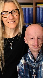 Our son is 25 but is ageing too quickly | Born Different