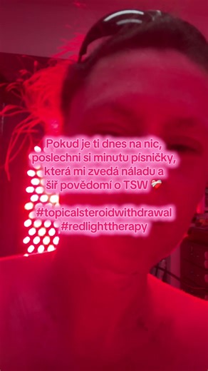 Tohle není ekzém (a ani se tak nedá léčit), jedná se o životy ničící syndrom Topical steroid withdrawal, který často vzniká jako vedlejší nežádoucí účinek po ukončení léčby kortikosteroidy a nikde se o tom dopředu nedozvíte‼️‼️‼️ Pomozte nám proto šířit osvětu o TSW 🙏🏻 Sdílejte mé, i ostatních TSW bojovníků, příspěvky, ať se do budoucna už tohle nikomu stát nemusí 🥹❤️‍🩹💯🤞🍀👏 ‼️‼️‼️A pokud sám/sama trpíš tímto syndromem, zaregistruj se na odkaze, který je na instagramu v biu u @itsan.nonpr