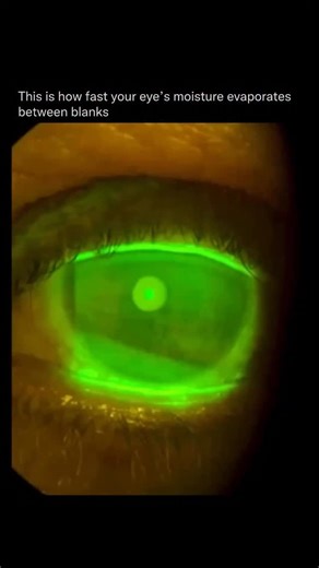 Did You Know on Instagram: "Your eyes start drying out seconds after you stop blinking. 👁️💧 This footage shows a tear break-up time test, where a harmless fluorescent dye makes the tear film visible as it spreads across the eye and then slowly evaporates. That thin tear layer is critical. It keeps vision clear, protects the surface of the eye, and prevents irritation. Each blink resets the system by spreading a fresh, protective film across the cornea. When the tear film breaks down too quickl