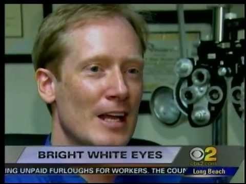 #1 Secret for White Eyes - How to Make Your Eyes Whiter with WhiterEyes™ No more Red Blood Shot eyes