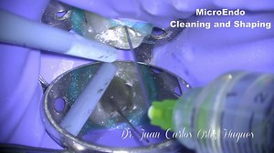 MicroEndo. Cleaning and shaping at low-middle step microscope magnification. Controlling details during all the steps of the endodontic treatment while we are well positioned and in a neutral work posture matters. #amed #advanceddentalergonomics #microscopedentistry #microendo | AMED - Academy of Microscope Enhanced Dentistry | Facebook