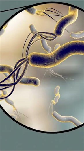 Gastritis and Peptic Ulcer Disease