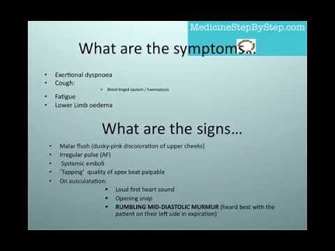 Understanding Mitral Stenosis Signs and Symptoms