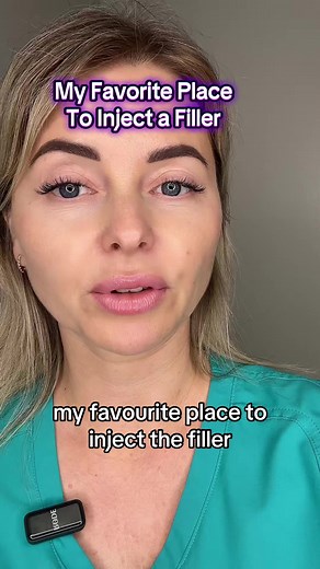 Transform Your Jawline with Filler Techniques