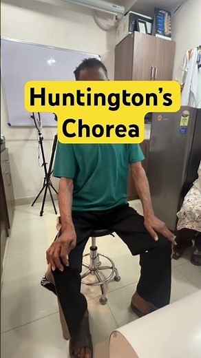 Huntington’s Chorea | Generalised Chorea #geneticdisease #huntingtonsdisease