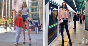 Woman With World’s Longest Legs Embraces Her Uniqueness and Inspires Others