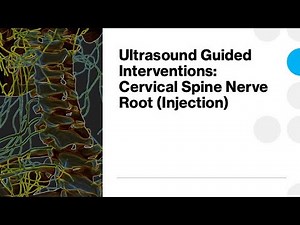 #ultrasound Guided Interventions: Cervical Spine Nerve Root (Injection)