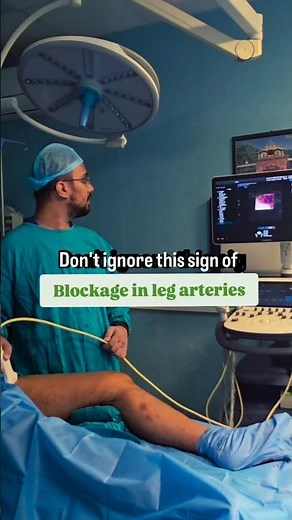 Claudication- when walking hurts