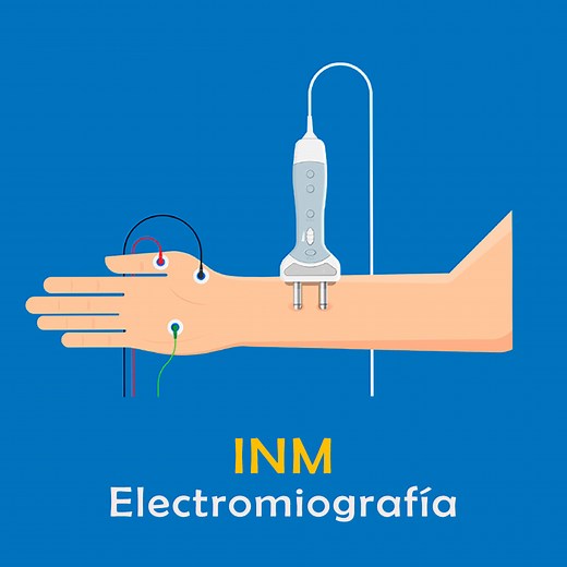 Electromiografía en Lima | Citas | Neurología - INM Instituto Neuro Metabólico