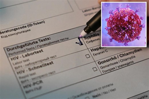 Doctors near HIV cure with ‘previously impossible’ discovery: ‘We have never seen anything close to as good’