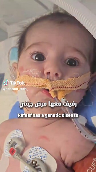 فعلوا الخير... انقذوا رفيف من مرض ضمور العضلات الشوكي