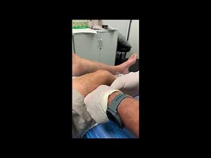 Monovisc Procedure with Dr Mark Ralfe