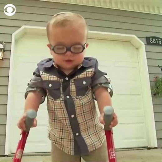 WALKING MIRACLE: Two-year-old boy with spina bifida beats the odds and learns how to walk, inspiring millions https://cbsn.ws/2OtlpiW | CBS News