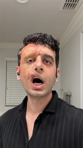 NAEIM on Instagram: "Acid attack / Burn victim makeup Inspired by Two Face, Dr Doom and Mason Verger • • • #Makeup #specialfx #art #face #villain"