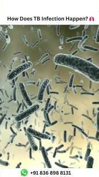 How Does TB Infection Happen 🫁 | Dr. Naveen Kumar Ailawadi, MBBS, MD, Pulmonologist - 8586805004