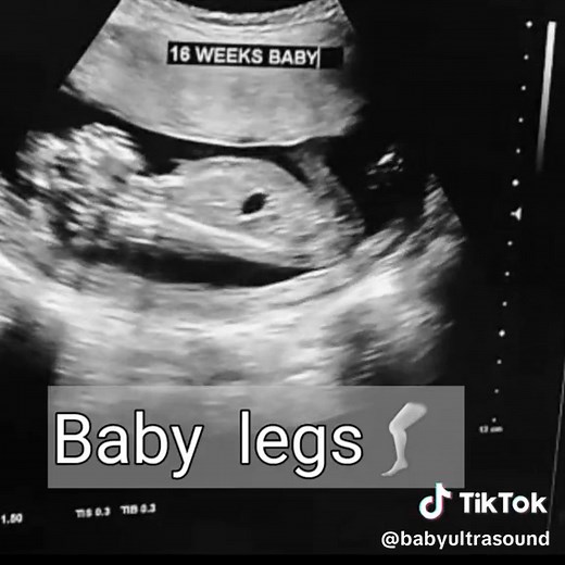 4 months baby in mothers womb #babykicks #babykicking #womenshealth #foryourpage #miracles #fyp #pregnancy #pregnant #birth #babiesoftiktok #babies #pregnancyweeks #pregnancyweekbyweek #wombmates #prenataldevelopment #Uterus #shorts