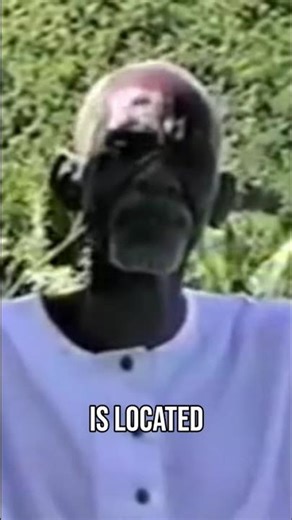 One Disease, Many Forms: Body's Mucous Membrane Explained #shorts