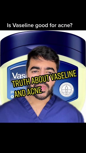 The Truth about Using Vaseline for Acne