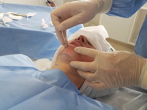 [Hot Item] Minimally Invasive Laser Surgery Vaser Liposuction Machine Clinic