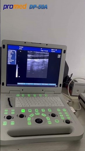 Laptop Ultrasound Scanner DP-50A [PROMED]