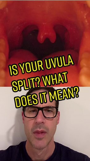 Understanding the Split Uvula: Causes and Effects
