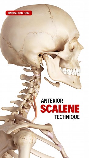 5.9K views · 150 reactions | Anterior Scalene Technique The...