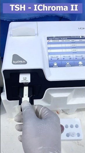 Quick TSH (Thyroid) Test on Ichroma 2 — Lab Tutorial #TSHTEST #Ichroma