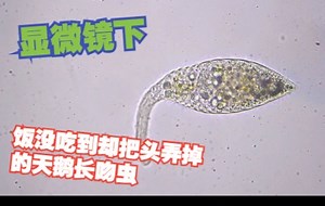 显微镜下-吃顿饭却把头弄掉了的Lacrimaria